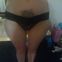 close up of thighs 25 days post op
