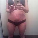 full body 25 days post op
