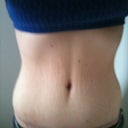 15 weeks post op