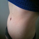 15 weeks post op