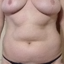 5 weeks pre op