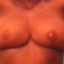 I took this 7 days after my surgery