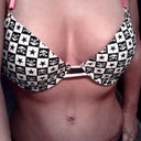 6 WEEKS post op: Feeling great