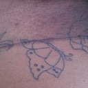 scar 1 year later just started my tattoo to cover it..i have to get it colored in..but it is still kinda dark but that may be just cause im African american..