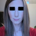 Two weeks post-op, in natural light so you can see how bad the swelling really is. Can't wait for this potato to shrink!