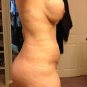 5 weeks PO. 
Side view...