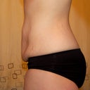 side view