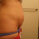 Side profile - the indent of my c-section is very unappealing and shows through a bathing suit.