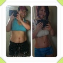 What do u guys think?  Worth it?  Pre op/ post op 14 weeks