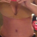 4 weeks post op