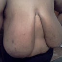 Before:Front View