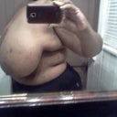 Before:Side View