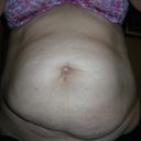 close up front view pre op