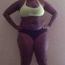 before lipo front view 222