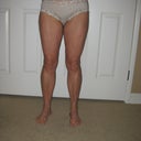 16 Days Post