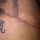 25 days after revision