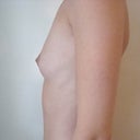 Before surgery
