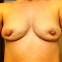 27 days post :/