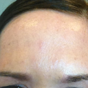 one week after touch-up, frowning... no "1"