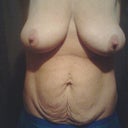 Front view no bra....eWWWWW