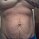 Front view of just stomach