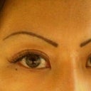 7 months post op, brows have been thinly tattooed in as well