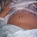 11-1-11 first look at my tummy ... oh my gosh I was so flat ... YEA!