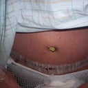 11-2-11 2nd day looking at tummy I think I looked at it 100 times :)