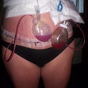 11-2-11 first day home :) 2 drains one on each side of hips area