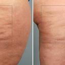 Cellulaze