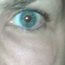 3/25/2013 Woke up with left under eye swollen - 12 hours later swelling is coming down.  Two weeks ago, the right eye was swollen.