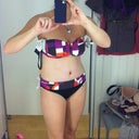 10 days post op!! Amazing