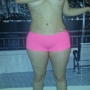 9 DAYS POST OP FRONT