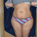 Front view pre surgery