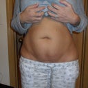 Front lower abdomen