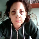 two days after surgery, very bruised and swollen! not sure why my face reacted this way :/