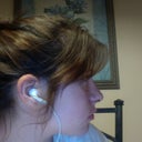 Side view (7 days post op)