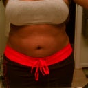 The morning of my surgery... my first "before" pic