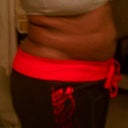 The morning of my surgery... my "before" pic