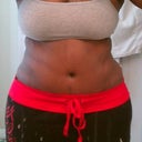 3wks 3 days postop