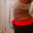 3wks 3 days postop