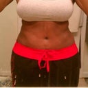 5wks postop