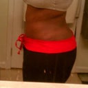 5wks postop