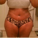 5wks postop