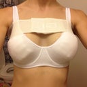 34 DD! Omg I hope the swelling goes down!post op day 1