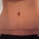 i love my scar and belly button.  these are taken at about 3 1/2 months