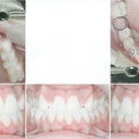 These are the photos my orthodontist took on day one, the markings on the top right are markings for attachments and things.