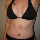The new me...so far.
Hopefully the rash goes away soon