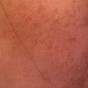 70 hour post-treatment (see the brown flakes?)