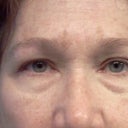 Eyes before